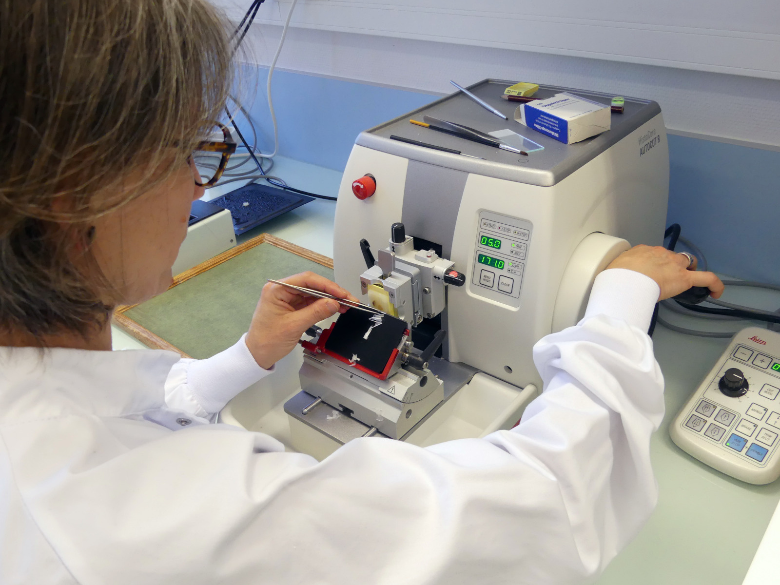 Une équipe de recherche révèle un nouveau mécanisme impliqué dans les troubles du neurodéveloppement